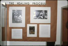 The healing process